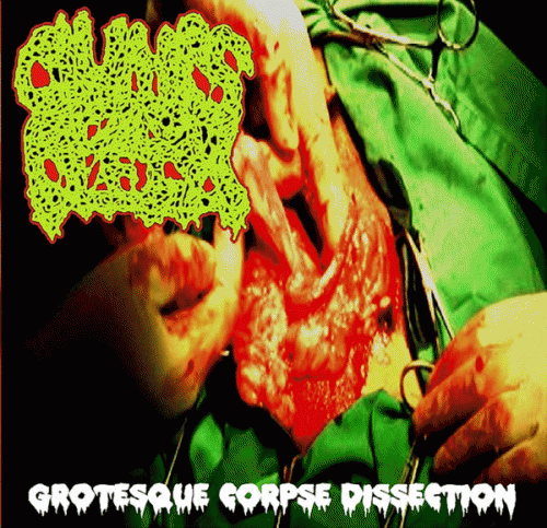 Clumps Of Flesh : Grotesque Corpse Dissection
